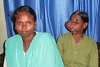 Urmila Digal zusammen mit ihrer 24-jährigen Tochter Rashmita Pradhan. Ihr Gesicht war durch den bösartigen Tumor völlig entstellt (csi)